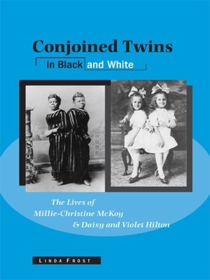 cover image of Conjoined Twins in Black and White